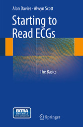 Starting to Read ECGs - The Basics